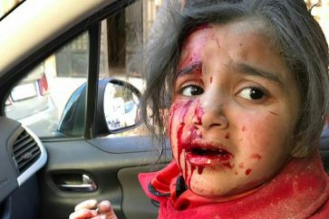 Une écolière blessée dans le bombardement de l'école Fourqane par les rebelles