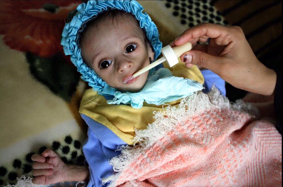yemen_famine