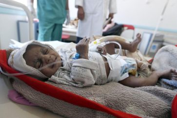 YEMEN-Cholera