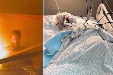 Le journaliste palestinien Ahmad Mansour a succombé à ses brûlures sévères, consécutives à une attaque israélienne qui a frappé une tente abritant des journalistes dans le sud de la bande de Gaza, le 8 avril 2025.