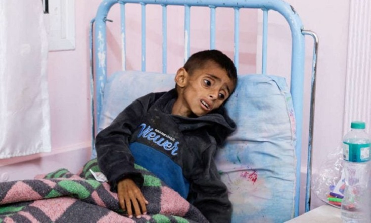 Un enfant palestinien affecté par la famine en raison du blocus israélien contre Gaza (Illustration)