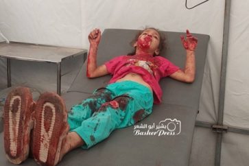 Une fillette palestinienne blessée par des tirs israéliens sur un groupe de palestiniens dans la rue Kachko du quartier Zeytoune à l’est de Gaza-ville.