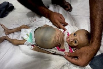 La petite Zainab Abu Hulaib a succombé à une faim impitoyable avant de fêter son premier anniversaire. Zainab s'est éteinte en silence, témoin, une fois de plus, du crime israélien qui ravage les enfants de Gaza.