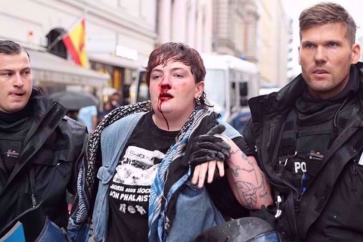 Une manifestante ensanglantée arrêtée par la police allemande lors d’un rassemblement pacifique pro-palestinien à Berlin, en Allemagne, le 29 août 2025. © Anadolu