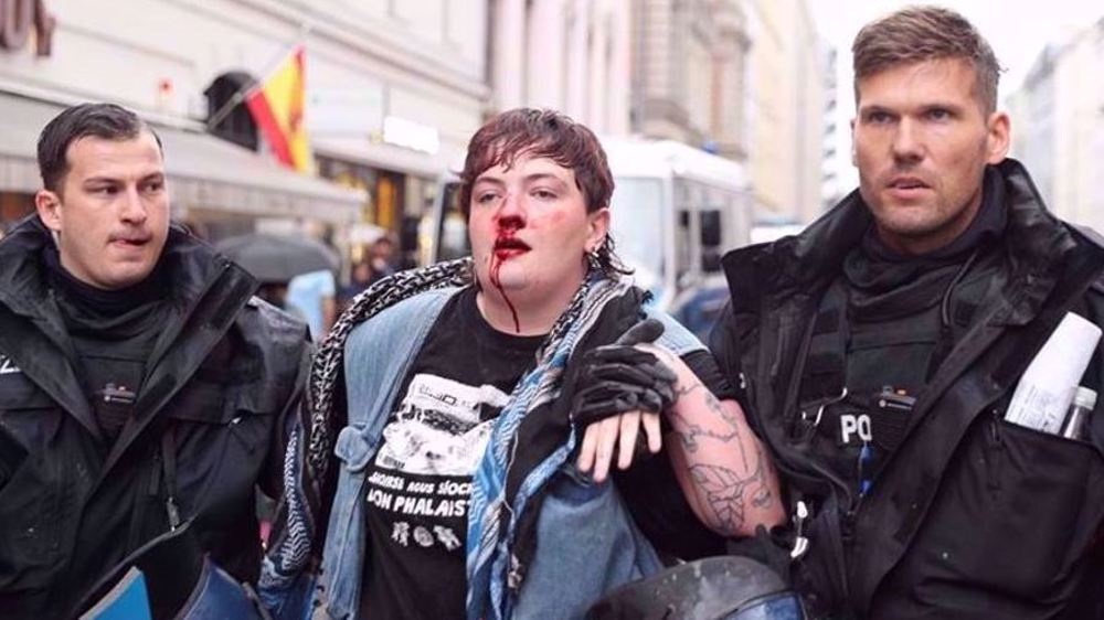 Une manifestante ensanglantée arrêtée par la police allemande lors d’un rassemblement pacifique pro-palestinien à Berlin, en Allemagne, le 29 août 2025. © Anadolu