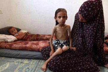 Mariam Dawas, une fillette palestinienne de neuf ans souffrant de malnutrition en raison du blocus israélien contre Gaza, le 2 août 2025 (Photo d'Omar AL-QATTAA / AFP)